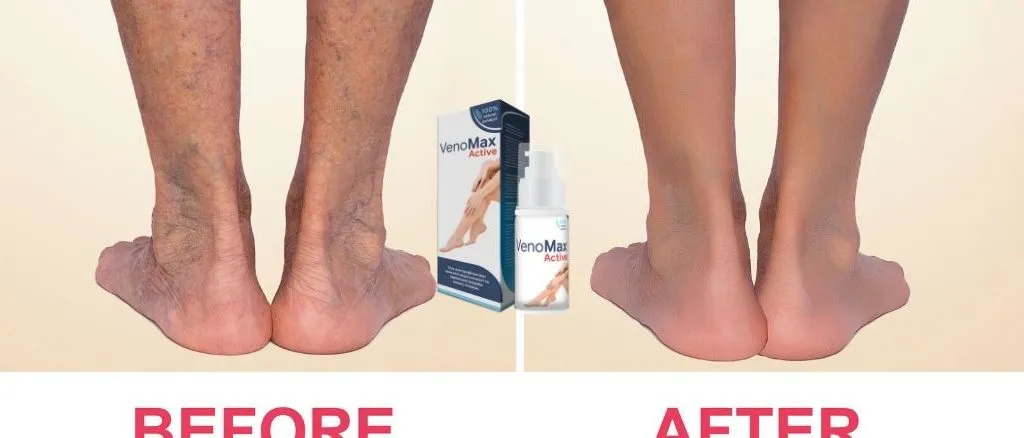 Varitone